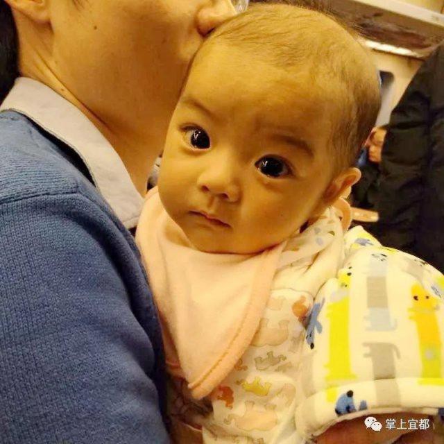 Từ lúc mới sinh ra, con gái cô Giang bị chẩn đoán mắc bệnh gan nghiêm trọng. (Ảnh: Internet)
