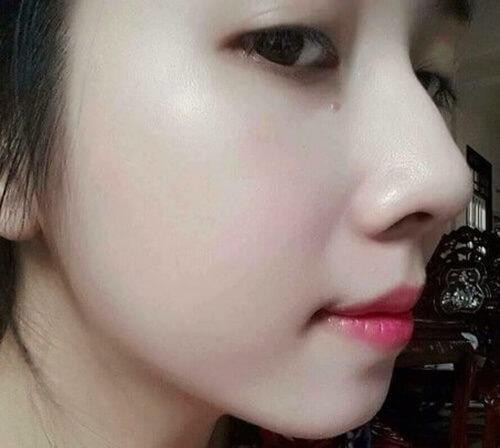 Da bạn sẽ trắng lên sau 2 tuần sử dụng