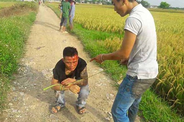 Đối tượng Lương bị người dân bắt giữ, hiện đang điều trị tại Bệnh viện Việt Đức