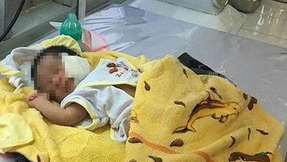 
Ch&aacute;u b&eacute; bị ch&ocirc;n sống
