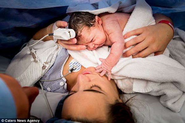 Khoảnh khắc xúc động của bé Olivia và mẹ trong ca sinh mổ hồi tháng 1. Ảnh: Caters.