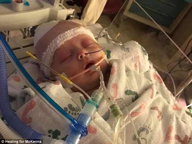 C&ocirc; b&eacute; vẫn chưa tỉnh dậy d&ugrave; đ&atilde; qua cơn nguy kịch. (Ảnh: dailymail)