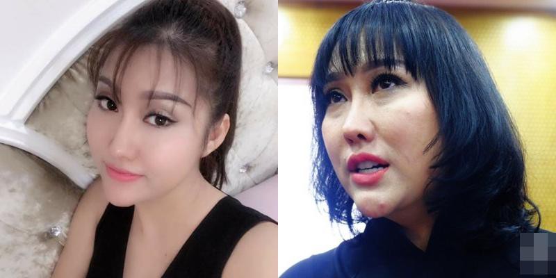 Khá đông người hâm mộ cho rằng, đây là những biến chứng mà cô gặp phải sau nhiều cuộc dao kéo lớn nhỏ. Cách đây 4 năm, Phi Thanh Vân cũng từng tiết lộ về việc gặp biến chứng sau phẫu thuật thẩm mỹ.