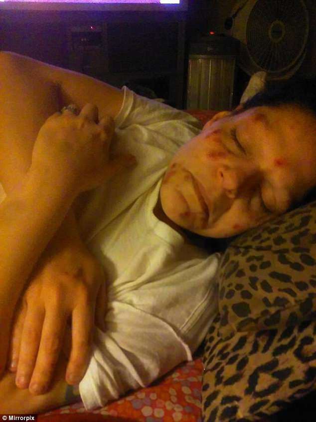 Melissia đã trải qua khoảng thời gian kinh khủng khiến cô không còn muốn sống trên đời vì nghiện ma túy. (Ảnh: Internet)