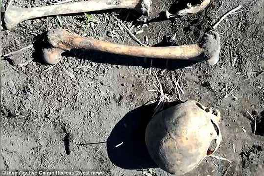 Sọ và xương người được một người đàn ông phát hiện trong lúc làm vườn. Ảnh: Ủy ban Điều tra Nga (RIC)