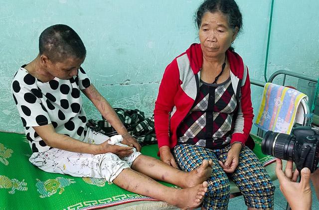 Y Nhiêu đang được chăm sóc tại trung tâm y tế huyện Đắk Glei