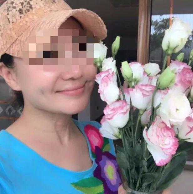 H&igrave;nh ảnh của b&agrave; Chu sau khi phẫu thuật thẩm mỹ. (Ảnh: QQ)