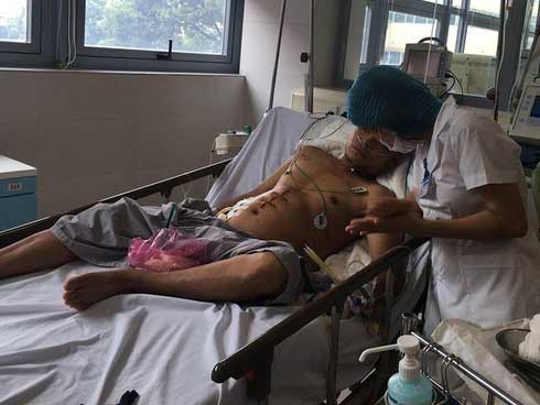 
Bệnh nhân viêm tuỵ cấp nặng nằm trong BV Bạch Mai
