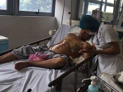 Bệnh nhân viêm tuỵ cấp nặng nằm trong BV Bạch Mai