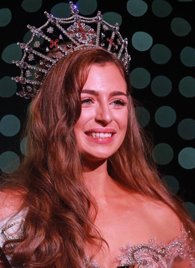 Alisha cũng được trao giải &ldquo;Miss Talent&rdquo; khi biểu diễn một b&agrave;i h&aacute;t bằng ng&ocirc;n ngữ k&yacute; hiệu. Alisha mất th&iacute;nh lực b&ecirc;n tai phải.