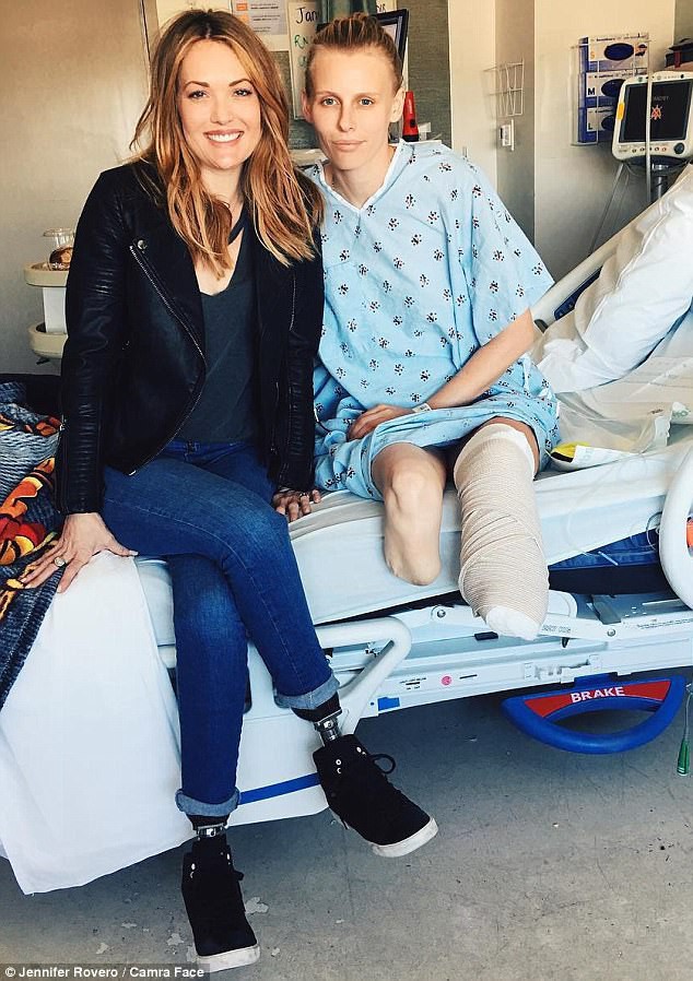 Người mẫu Lauren Wasser (bên phải) - đã chấp nhận cắt chân còn lại của mình vào tuần trước. Cô được Paralympian Amy Purdy (trái) thăm viếng, cũng là một người bị mất cả hai chân.