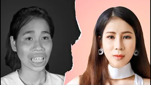 Thế nhưng sự háo hức ấy đã thay bằng nước mắt buồn bã khi vừa bước vào nhà, mẹ Lan - bà Hương không nhận ra con gái.