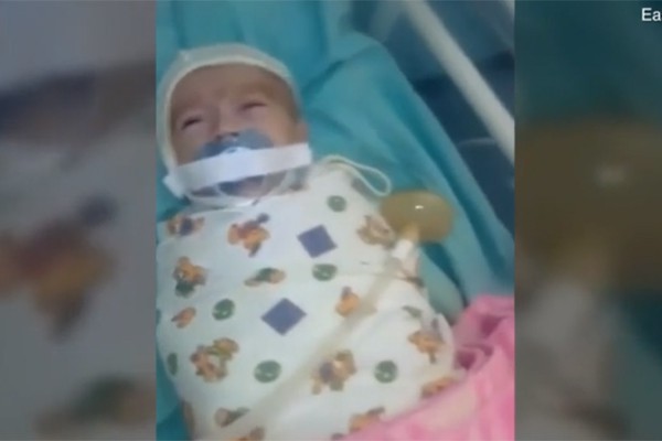 
Em b&eacute; bị d&aacute;n băng d&iacute;nh v&agrave;o mồm.
