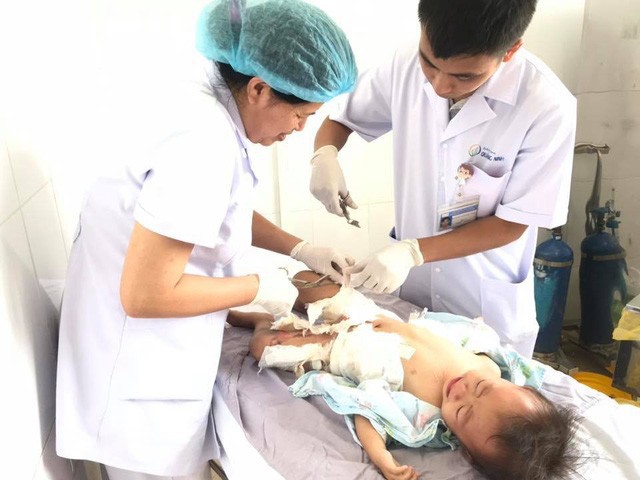 Quảng Ninh: Trẻ bỏng nặng vì ngã vào chậu nước sôi - Ảnh 1.