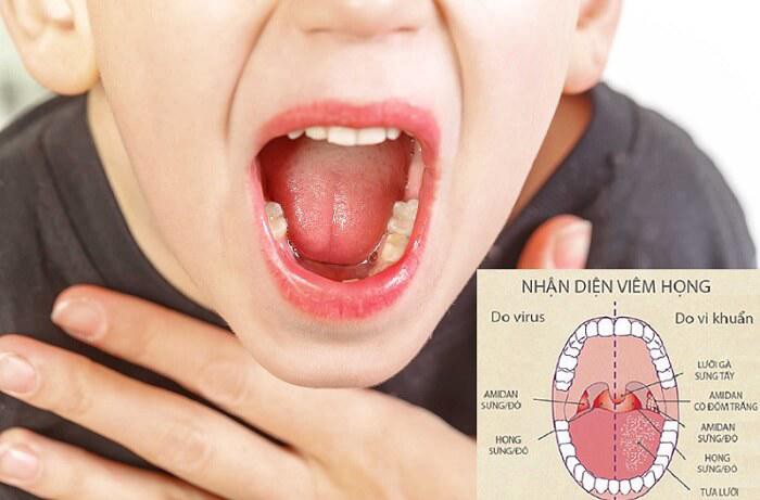 Giao mùa, nếu bố mẹ có thói quen này, con dễ mắc viêm họng và nhiều bệnh nguy hiểm khác - Ảnh 1. Giao mùa, nếu bố mẹ có thói quen này, con dễ mắc viêm họng và nhiều bệnh nguy hiểm khác - Ảnh 1.