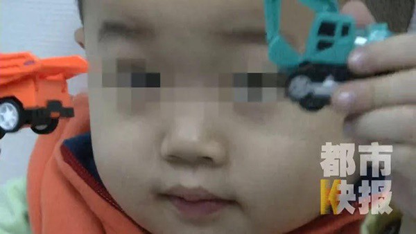 Bé trai 3 tuổi bị mù suốt 10 ngày chỉ vì bị cảm lạnh nhưng không điều trị dứt điểm - Ảnh 2.