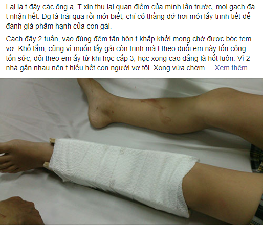 Tâm sự mỏng của anh chồng số đỏ nhất hội Adam: Tự hào vì lấy được vợ còn trinh nhưng sau đêm tân hôn vợ đột nhiên thú nhận sự thật sóc óc - Ảnh 1. Tâm sự mỏng của anh chồng số đỏ nhất hội Adam: Tự hào vì lấy được vợ còn trinh nhưng sau đêm tân hôn vợ đột nhiên thú nhận sự thật sóc óc - Ảnh 1.