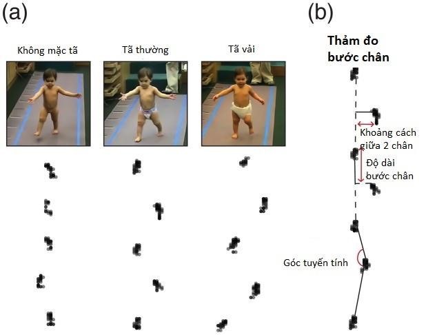 Đừng để tã xệ, vón cục ảnh hưởng xấu đến vận động của trẻ - Ảnh 1.