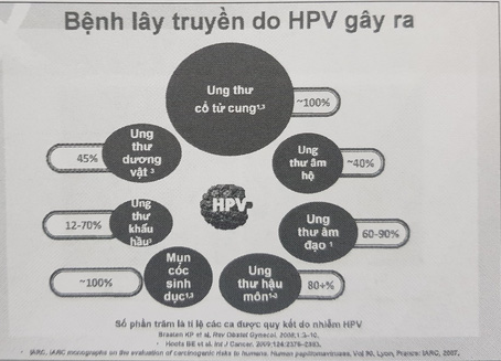 Hàng nghìn phụ nữ Việt mất mạng vì ung thư cổ tử cung, phát hiện bệnh bằng phương pháp nào? - Ảnh 3.