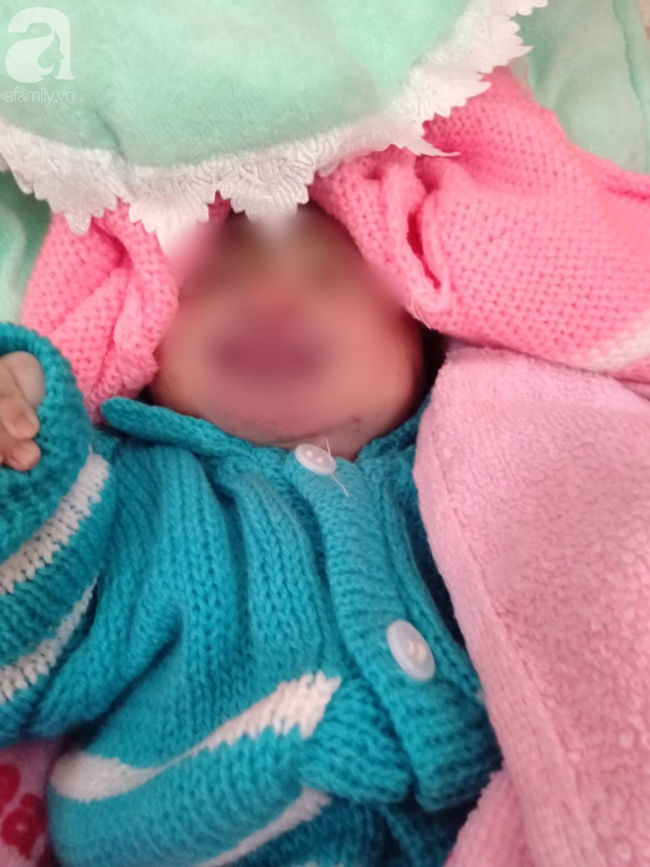 Bé gái Kon Tum nghi bị mẹ bỏ xuống hố phân sâu suy hô hấp, dạ dày còn máu và kiến cắn nhiều - Ảnh 2. Bé gái Kon Tum nghi bị mẹ bỏ xuống hố phân sâu suy hô hấp, dạ dày còn máu và kiến cắn nhiều - Ảnh 2.