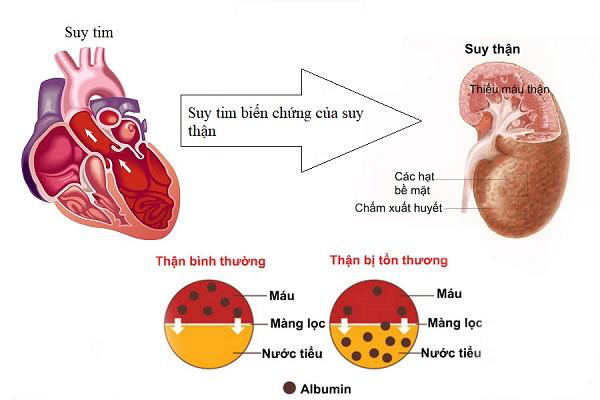 Vượt qua biến chứng của bệnh sốt xuất huyết nhờ bộ đôi cốm Subạc và gel Subạc - Ảnh 2.