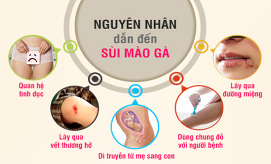 Tìm hiểu về bệnh sùi mào gà - Ảnh 2.