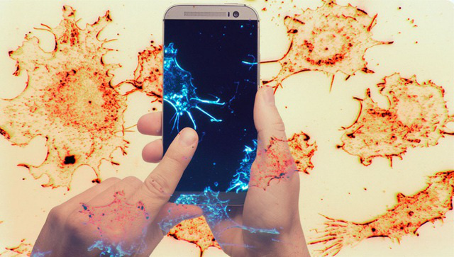 Trẻ đối mặt với nguy cơ u não cao gấp 5 lần do nghiện smartphone - Ảnh 2.