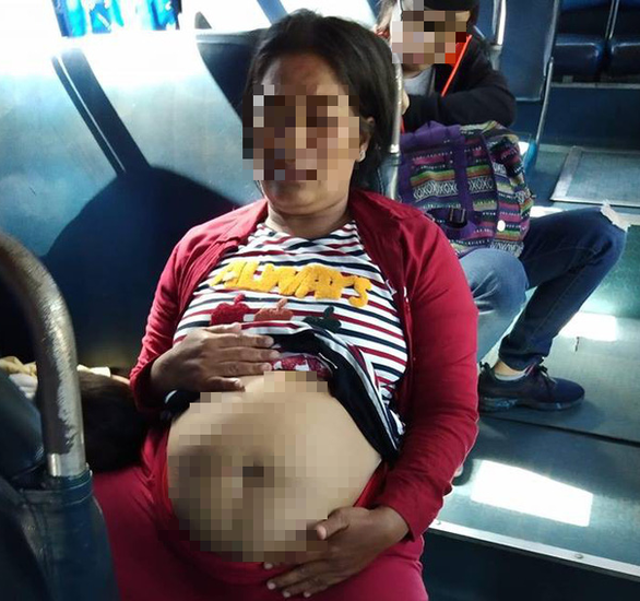 Người phụ nữ kéo áo để lộ bụng to như mang bầu - Ảnh: CTV