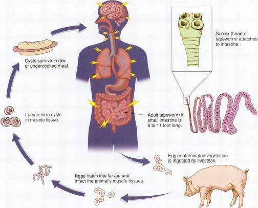 
Hành trình lây nhiễm bệnh sán lợn vào cơ thể người.

