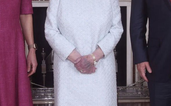 Cận cảnh đôi bàn tay tím bầm của Nữ hoàng Anh.