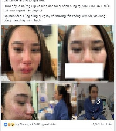 Hình ảnh và dòng chia sẻ của cô gái là nạn nhân trong vụ đánh ghen ở Vincom Bà Triệu. Ảnh facebook
