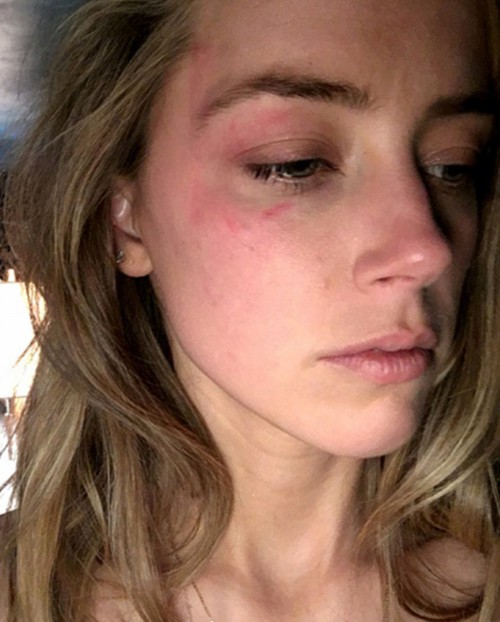 Amber Heard ra tòa vào tháng 5/2016, tố cáo Johnny đã ném điện thoại vào mặt cô.