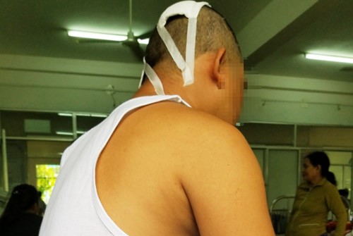 Em vợ cũ của Dũng với vết thương ở đầu. Ảnh: Đắc Thành.
