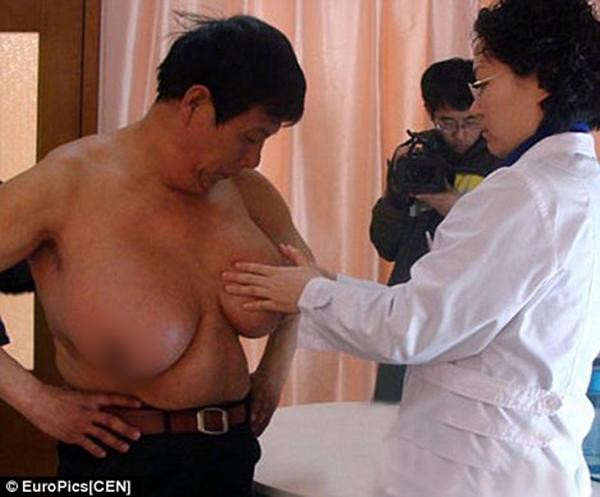 
Ngực của ông Guo Feng lớn đến mức trễ gần tới rốn.
