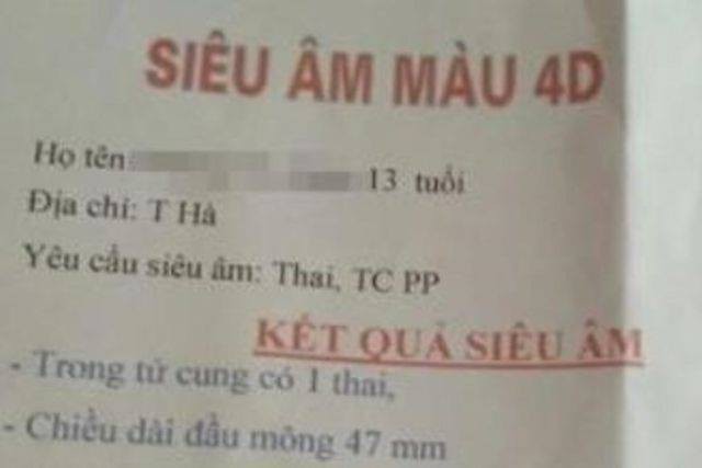Kết quả siêu âm thai nhi. Ảnh: Gia đình cung cấp