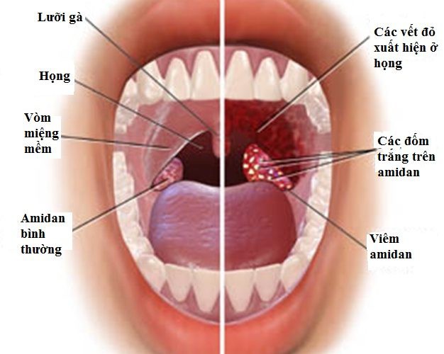 
Ảnh minh họa
