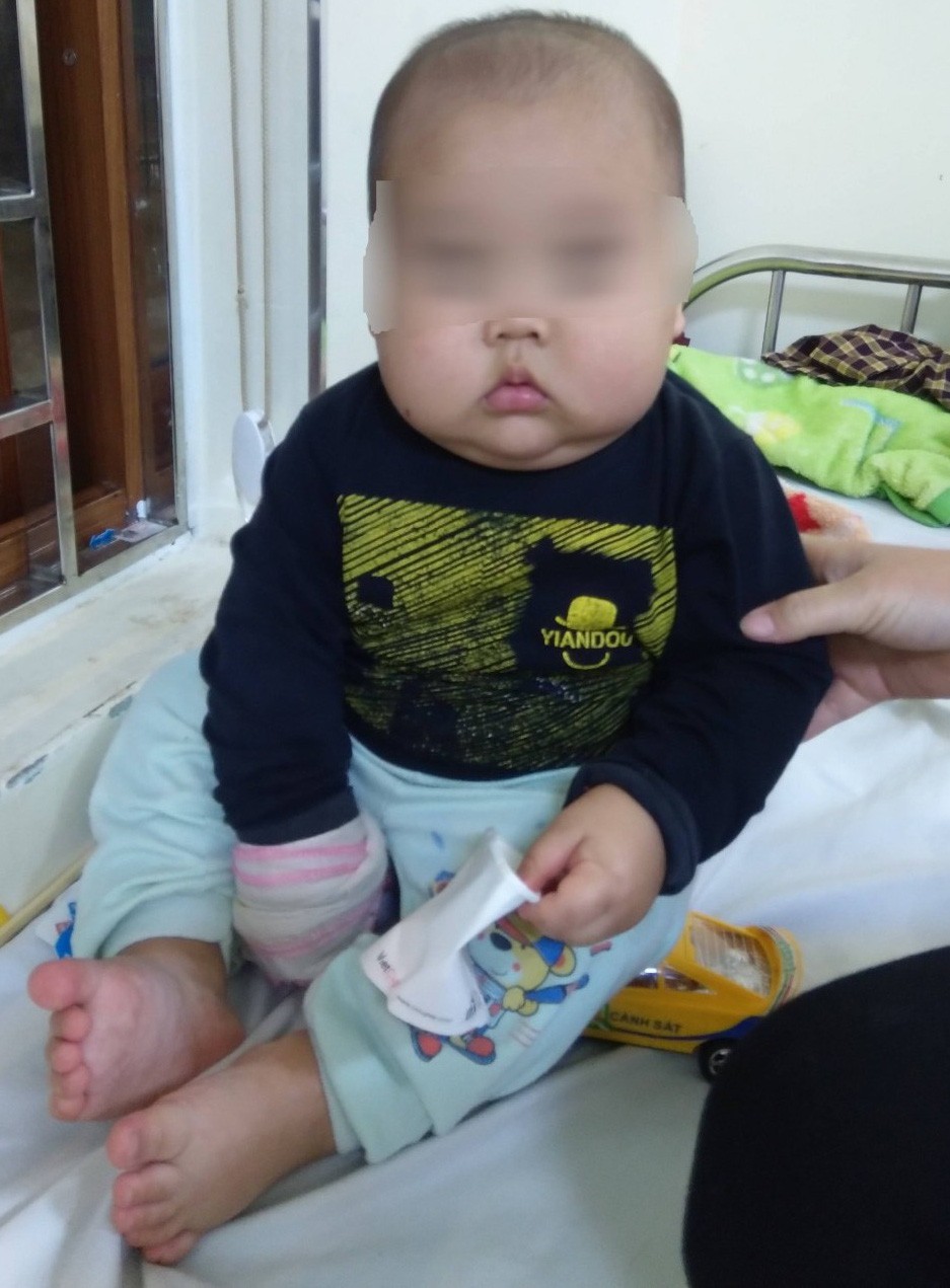 2 tháng gần đây, bé tăng 3 cân, mặt béo tròn. Ảnh : BVCC