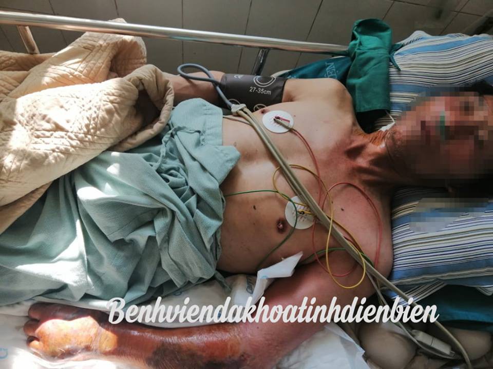  Nguồn ảnh: Bệnh viện đa khoa tỉnh Điện Biên 