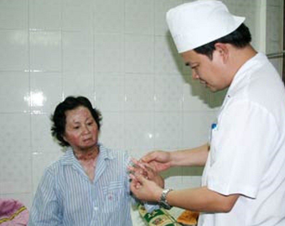  Bác sĩ khám chữa cho một bệnh nhân bỏng. Ảnh: TL 