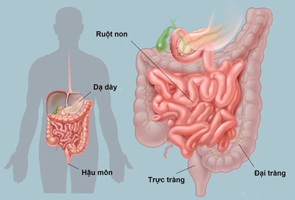 
Khối u đường tiêu hóa rất dễ bị di truyền
