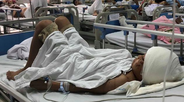 
Bé Thảo đang được điều trị tại Bệnh viện Việt Đức
