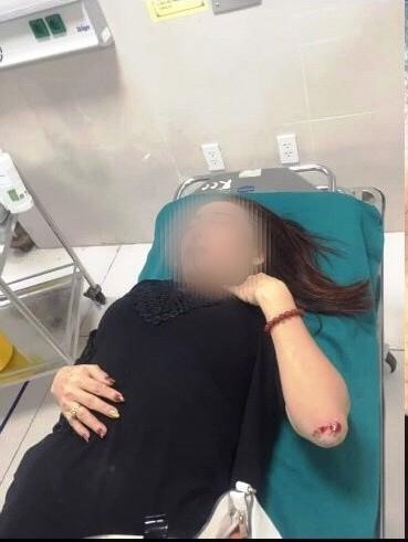 
Bà Thức tố mình bị bắn vào tay sau đó bị đánh dẫn tới chảy máu phải nhập viện.
