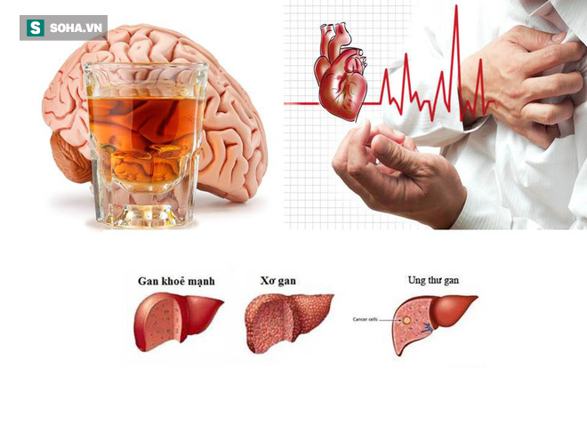Uống rượu bia thường xuyên: 5 cơ quan nội tạng bốc hơi đáng giật mình - Ảnh 1.