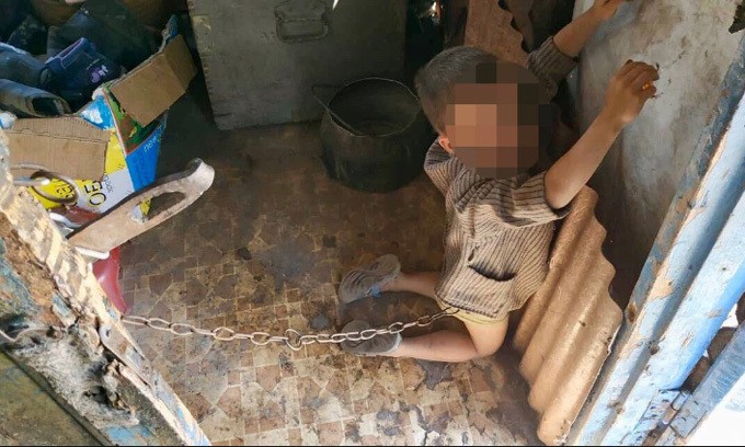 Cậu b&eacute; bị x&iacute;ch bằng d&acirc;y sắt trong nh&agrave; m&igrave;nh h&ocirc;m 27/6. Ảnh: Police of Ukraine. 