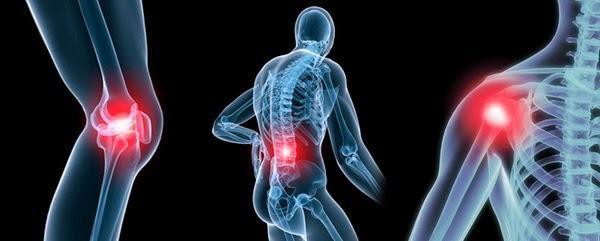 Bệnh viêm khớp ảnh hưởng đến các khớp xương trong cơ thể