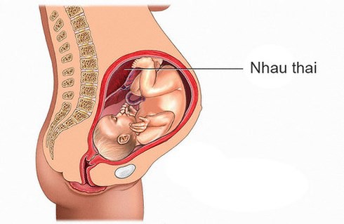 Tai biến sản khoa mà Thư trong Về nhà đi con gặp phải nguy hiểm như thế nào mà ông Sơn tái mặt? - Ảnh 2.