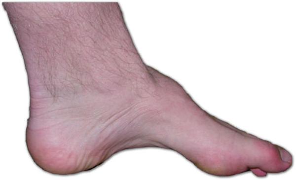 Dấu hiệu bất thường trên chân tiết lộ tình trạng sức khỏe của bạn  - Ảnh 1.