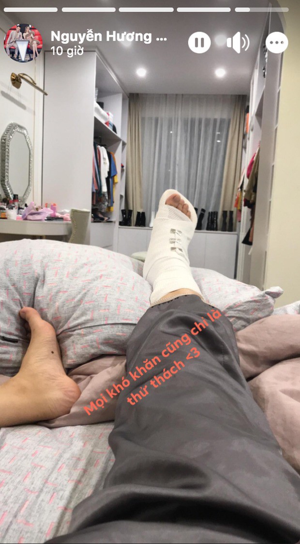 Gặp chấn thương ở chân, Hương Giang đăng đàn nhờ hỗ trợ tìm bác sĩ chỉnh hình - Ảnh 1.