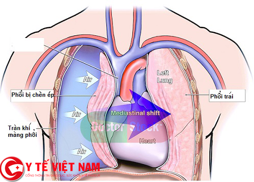 Những bệnh tiềm ẩn khi hát karaoke ai cũng dễ mắc phải - Ảnh 2.