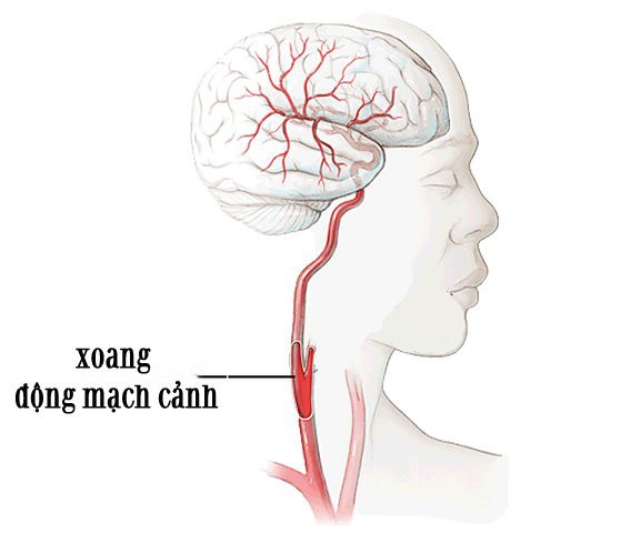 Cô dâu đột tử vì chú rể hôn quá mãnh liệt, 4 điểm trên cơ thể tránh tác động mạnh  - Ảnh 1.